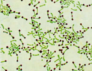 corynebacterium