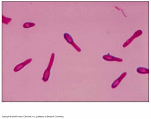 Clostridium-tetani_jpg