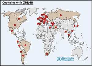 xdr-tb